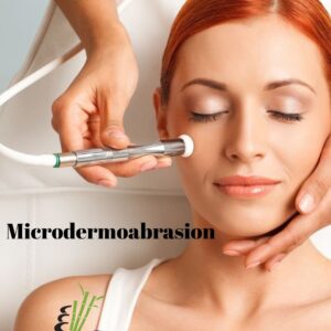 Microdermoabrasion 50% de descuento
